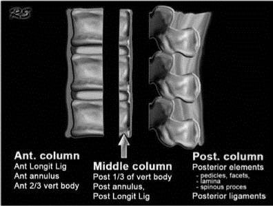 EMR061812 fig 6 three spinal column of Denis.jpg