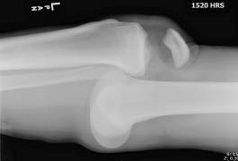 TR0701fig 2 a anterior knee dislocation.pdf