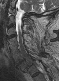 Figure 9b - MRI.jpg