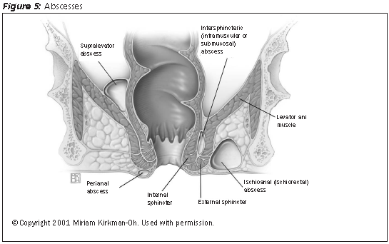 Anorectal Emergencies 2009-12-07 AHC Media Continuing Medical