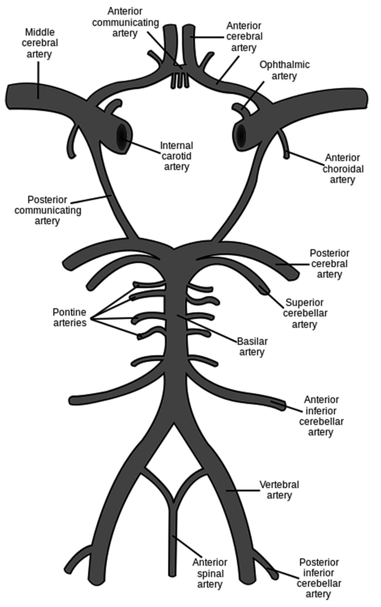 circle of Willis