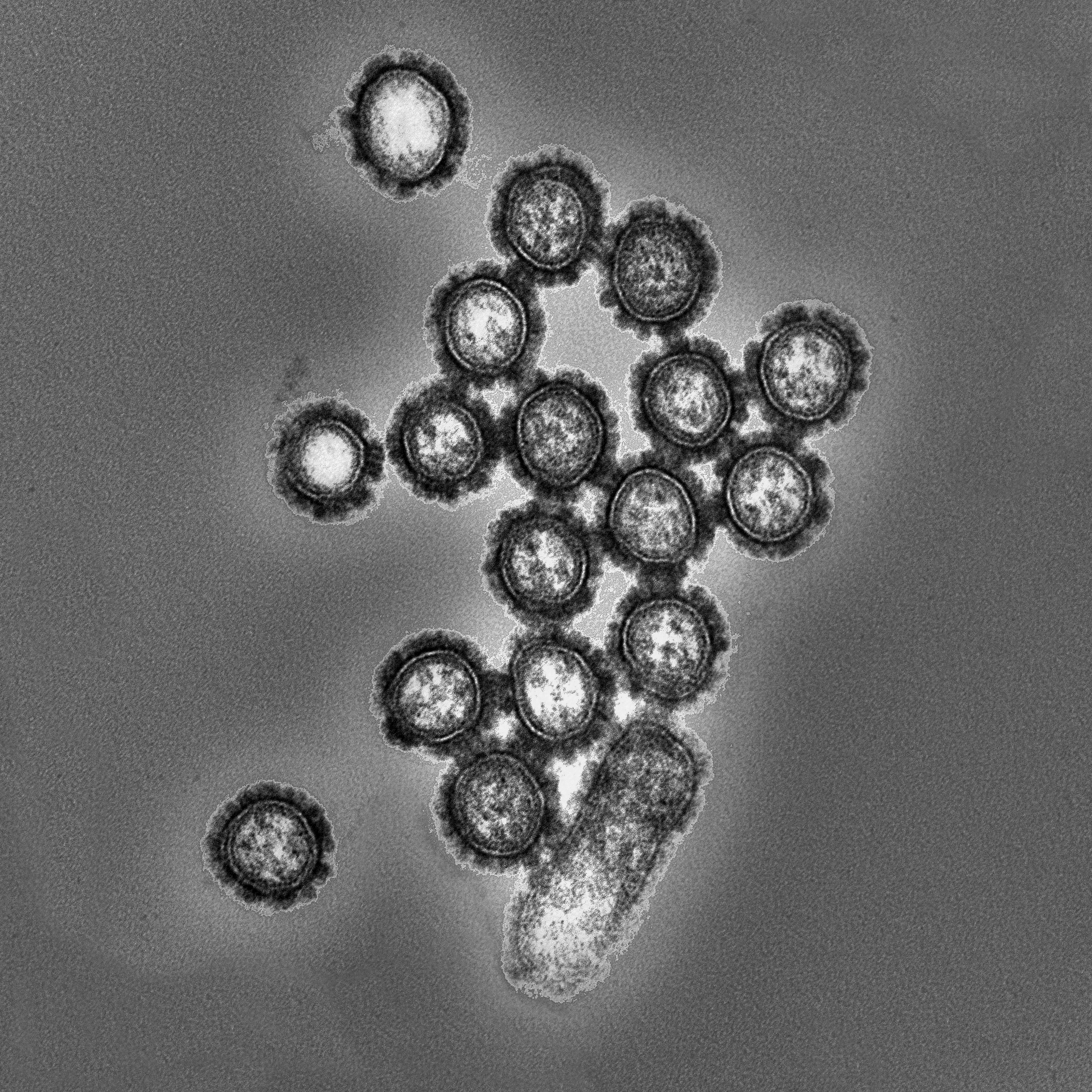 Figure 2 influenza virus particles