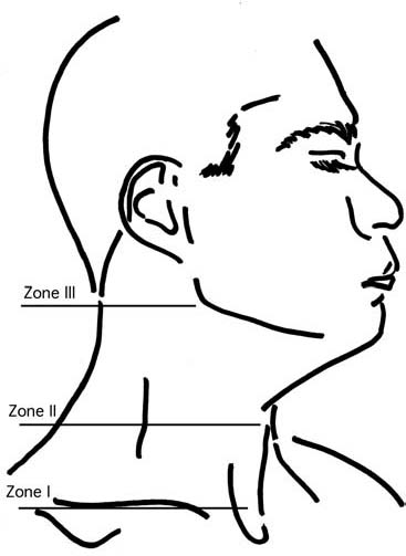 Zones of the neck