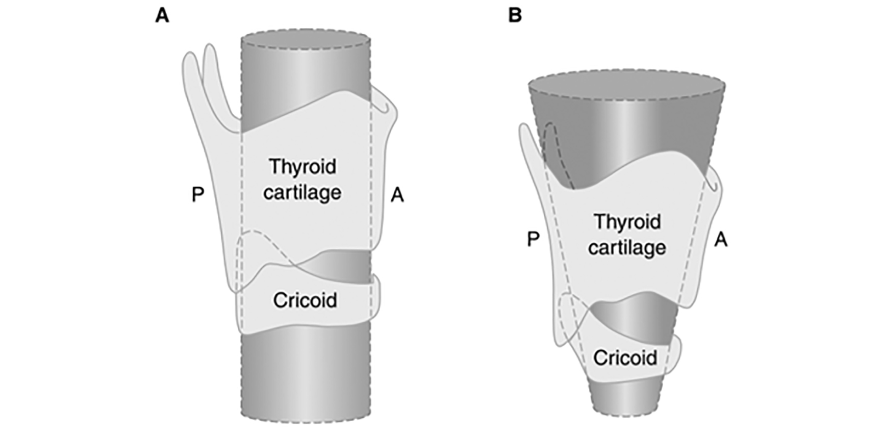 airway diagram