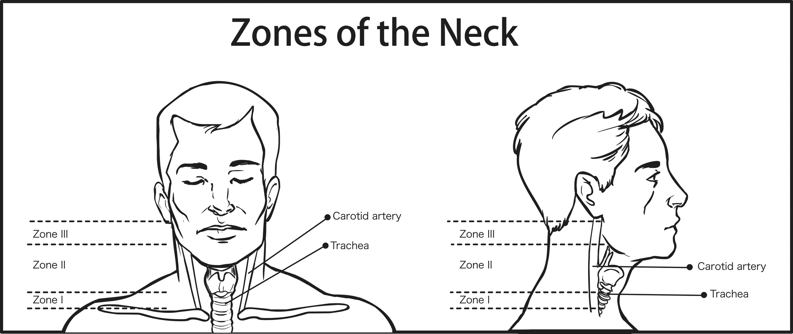 Zones of the neck